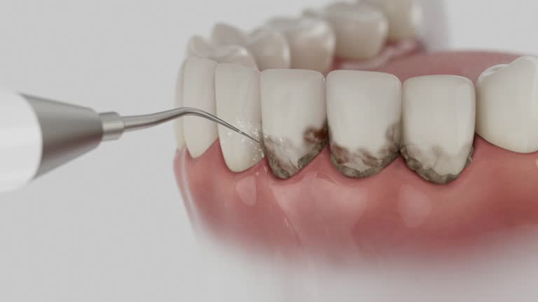Trusted Dental Implants service in Queens Gate, PA - Dentist Open Now